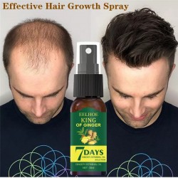 30ml Hair Growth Essence Germinal Serum Essence Oil 