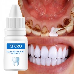 EFERO Teeth Whitening Essence Oral Hygiene Product